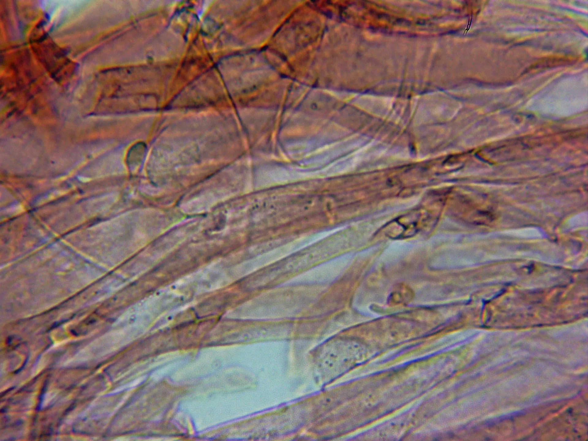Microscopía de Mycena pelianthina - 4 - Hifas cutícula